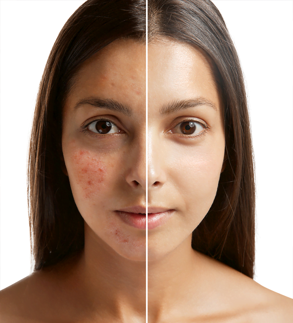 1000 x 1100 Pic for Website